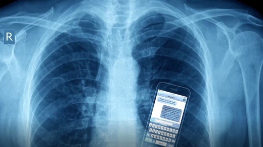 Phone in lungs